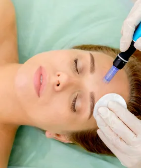 Microneedling Packages